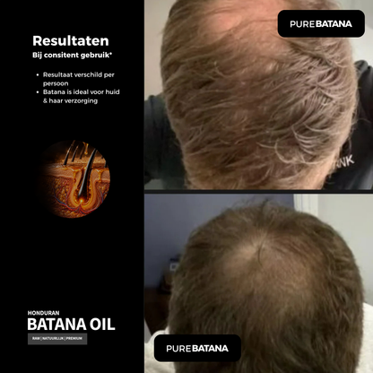 100% Raw Batana Oil (haarolie)