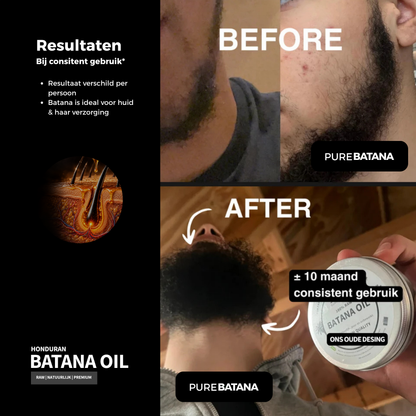 100% Raw Batana Oil (haarolie)