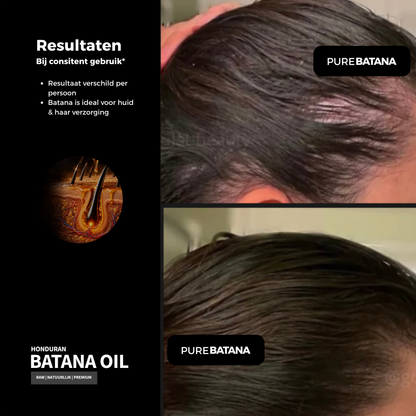 100% Raw Batana Oil (haarolie)
